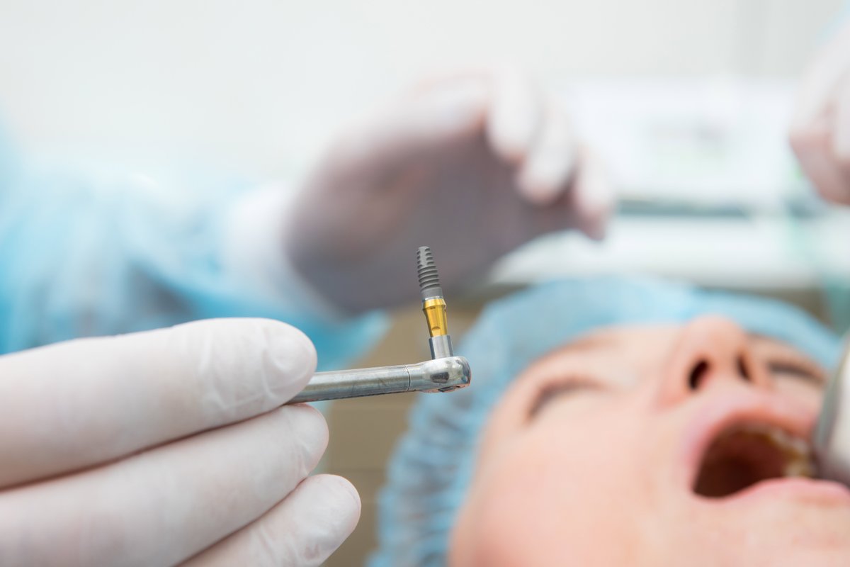 Dental implants