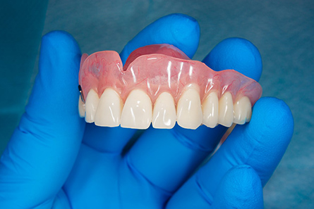 Denture type